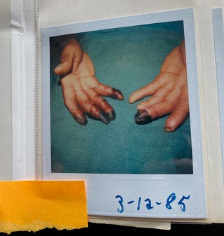 MEDICALLY EXPLICIT PHOTO ALBUMS 1984-86; 1988-92