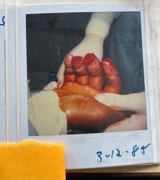 MEDICALLY EXPLICIT PHOTO ALBUMS 1984-86; 1988-92