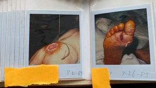 MEDICALLY EXPLICIT PHOTO ALBUMS 1984-86; 1988-92