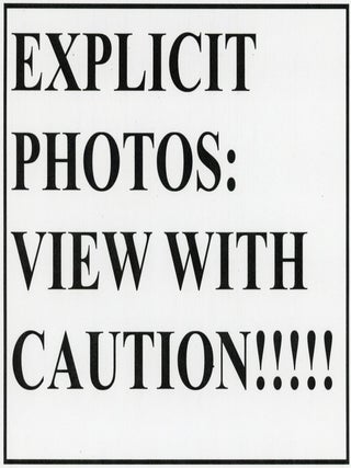 MEDICALLY EXPLICIT PHOTO ALBUMS 1984-86; 1988-92