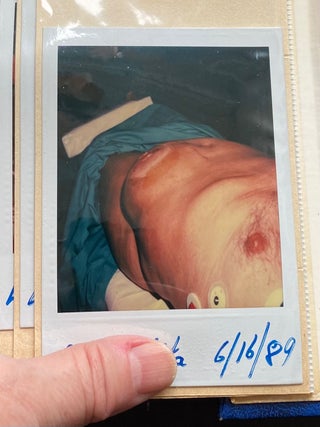 MEDICALLY EXPLICIT PHOTO ALBUMS 1984-86; 1988-92