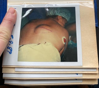 MEDICALLY EXPLICIT PHOTO ALBUMS 1984-86; 1988-92