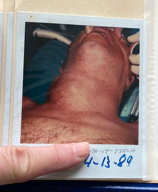 MEDICALLY EXPLICIT PHOTO ALBUMS 1984-86; 1988-92