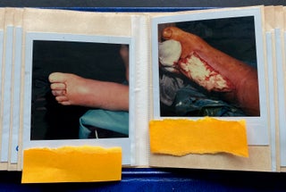MEDICALLY EXPLICIT PHOTO ALBUMS 1984-86; 1988-92