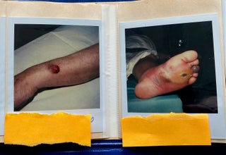 MEDICALLY EXPLICIT PHOTO ALBUMS 1984-86; 1988-92