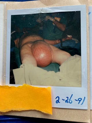 MEDICALLY EXPLICIT PHOTO ALBUMS 1984-86; 1988-92
