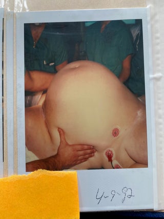 MEDICALLY EXPLICIT PHOTO ALBUMS 1984-86; 1988-92