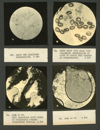 SCIENTIFIC RESEARCH ON BILIARY DRAINAGE PHOTO ALBUM WITH RESEARCH WITH WOMEN CONTRIBUTORS 1935