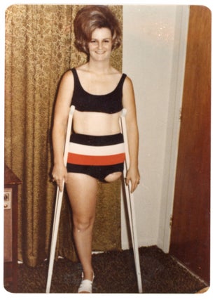 VINTAGE PHOTO COLLECTION OF WOMEN MISSING LIMBS AND AMPUTEES