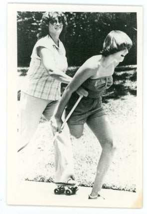 VINTAGE PHOTO COLLECTION OF WOMEN MISSING LIMBS AND AMPUTEES