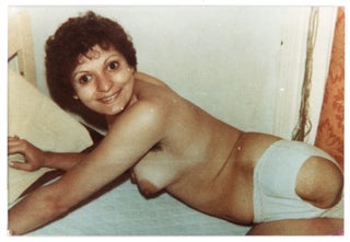 VINTAGE PHOTO COLLECTION OF WOMEN MISSING LIMBS AND AMPUTEES
