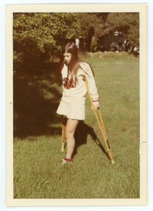 VINTAGE PHOTO COLLECTION OF WOMEN MISSING LIMBS AND AMPUTEES
