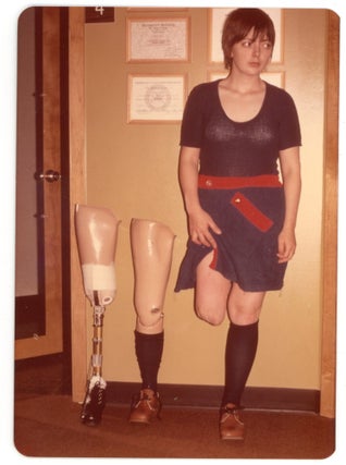 VINTAGE PHOTO COLLECTION OF WOMEN MISSING LIMBS AND AMPUTEES