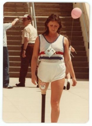 VINTAGE PHOTO COLLECTION OF WOMEN MISSING LIMBS AND AMPUTEES