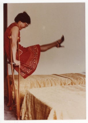VINTAGE PHOTO COLLECTION OF WOMEN MISSING LIMBS AND AMPUTEES
