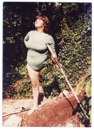 VINTAGE PHOTO COLLECTION OF WOMEN MISSING LIMBS AND AMPUTEES