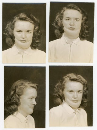 CHILD WITH SEVERE DEFORMITIES, PERHAPS FROM BURNS, OVER THE YEARS - MEDICAL PHOTOS